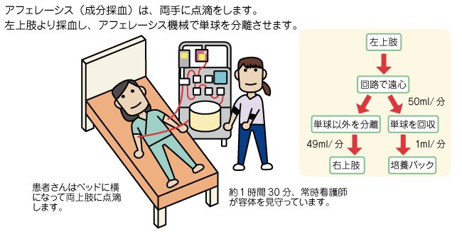 アフェレーシス 成分採血