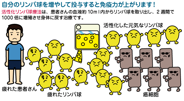 胃癌 活性化リンパ球療法