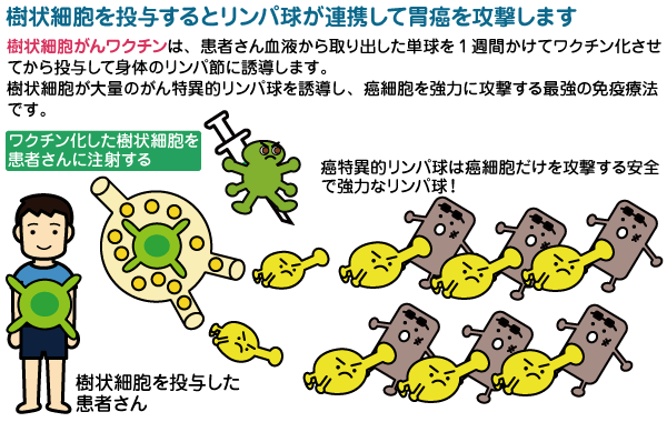 胃癌 樹状細胞がんワクチン