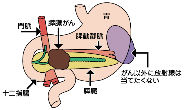 膵臓の周囲解剖